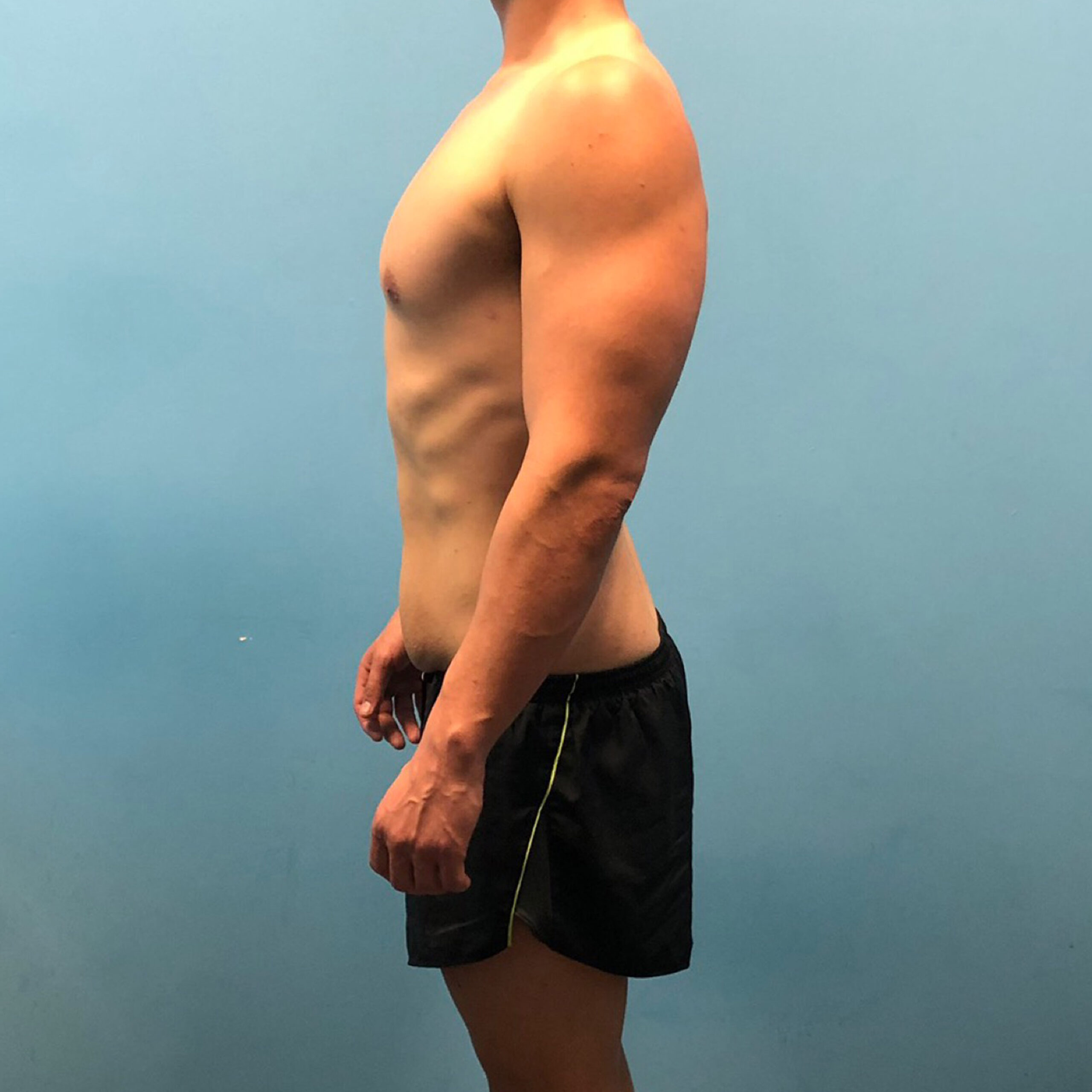 After image alt